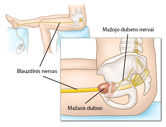 prostatos stimuliacija erekcijos metu