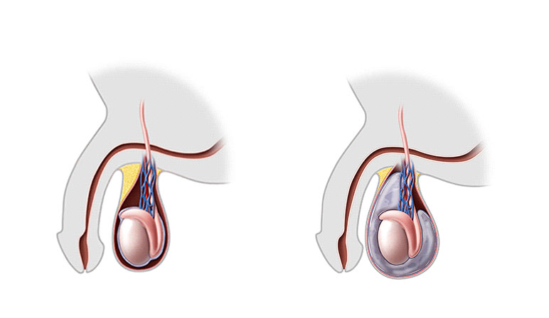 Urologo užrašai. Kodėl širdis viena, o sėklidės – dvi?