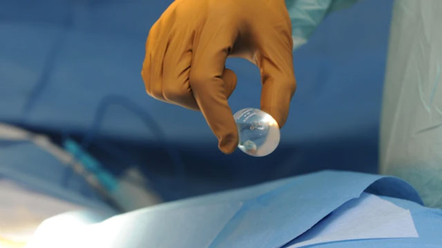 Sėklidės implantas